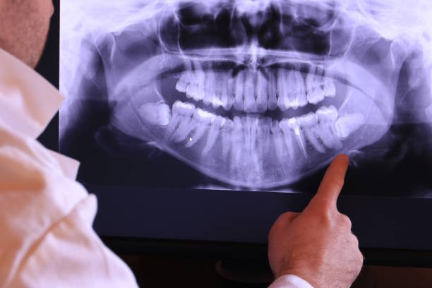 Best Emergency Care for Gum Disease in Venersborg, WA