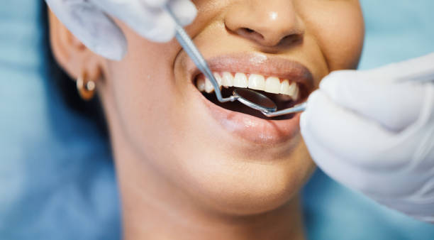 Best Emergency Denture Repair in Venersborg, WA