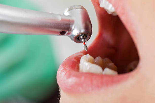 Best Emergency Denture Repair in Venersborg, WA